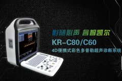 國產彩超機價格哪個好?選購彩超機注