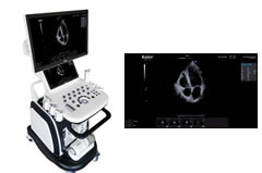 <b>心臟彩超機做心臟彩超 排除腫瘤不可少</b>