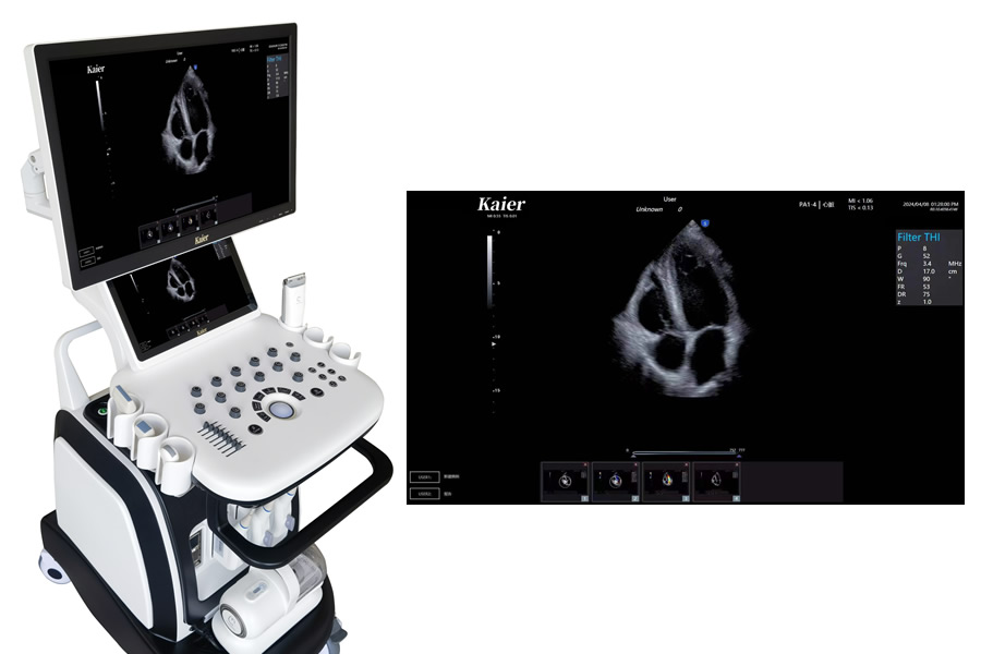 心臟彩超機做心臟彩超
