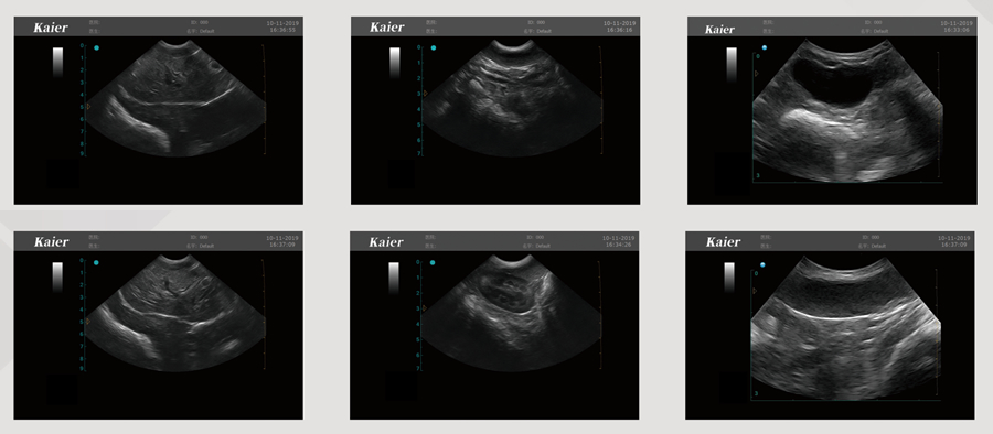 KR-8288Z全數(shù)字推車(chē)式B超機(jī)