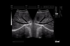 不同部位B超檢查前的準備工作有哪些？