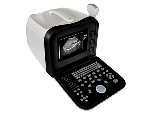 便攜式全數字B超
