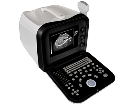 便攜式全數字B超