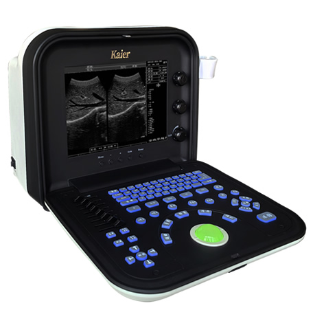 便攜式液晶全數字B超