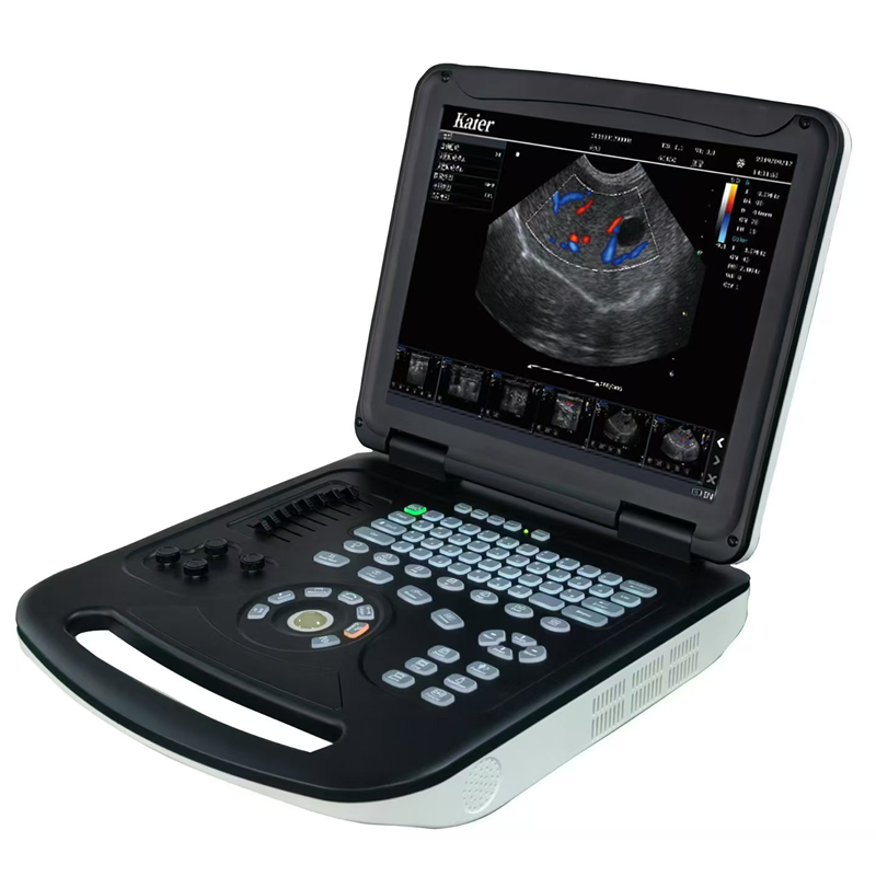 KR-E80筆記本式彩超機