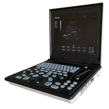 筆記本B超機(jī)